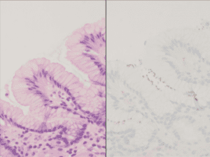 Identification of Helicobacter pylori Organisms by Digital Image