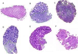 AI-Based Digital Image Analysis for Pathological Categorization of