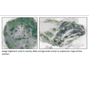 Predicting response to naratuximab emtansine, an anti-CD37 antibody-drug conjugate (ADC), in combination with rituximab in Diffuse Large B Cell Lymphoma (DLBCL), by analyzing the spatial arrangement of CD37 and CD20 positive cells using deep learning