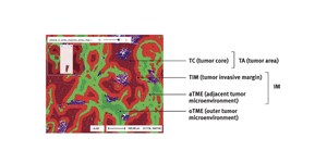Predicting CD8+ cell density and tumor-immune phenotypes in non-small-cell lung cancer (NSCLC) from standard H&E slides using deep learning (DL)