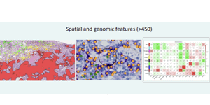 Predicting response to immune checkpoint inhibitors (ICI) in non-small-cell lung cancer (NSCLC) by combining spatial analysis of cells and RNA sequencing data from biopsies using deep learning (DL)
