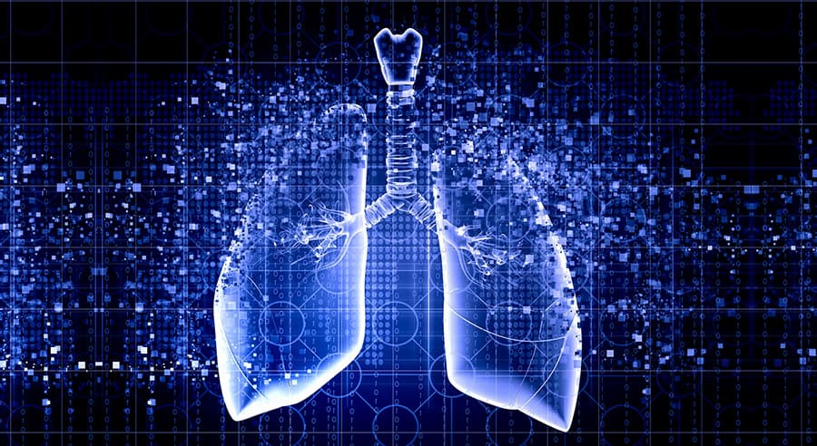 PD-L1 scoring in NSCLC